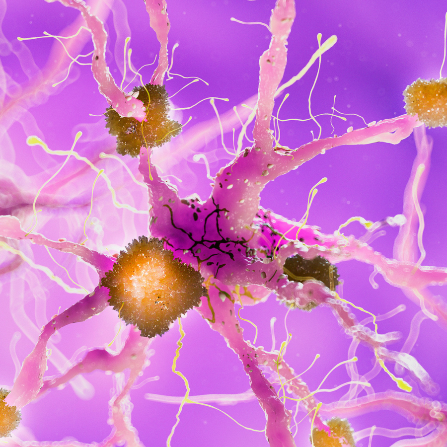 KP et hormones : pourquoi certaines périodes de la vie rendent la peau plus granuleuse