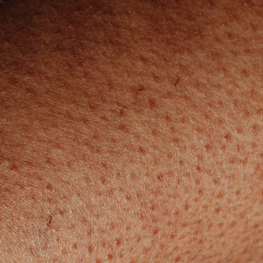 Pourquoi votre peau « accroche » au toucher ?