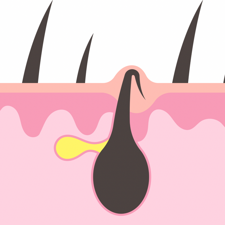 Kératose pilaire : comprendre cette peau granuleuse et la lisser en douceur