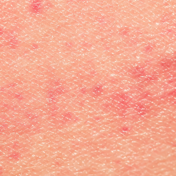 Image fondatrice SYKERA